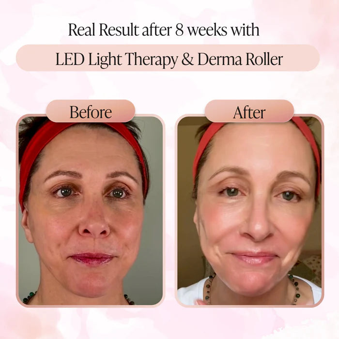 Silkiee DermaFace Pro™