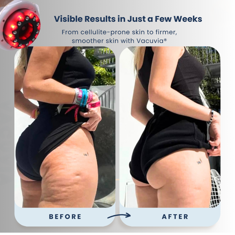 Silkiee SkinSculpt™