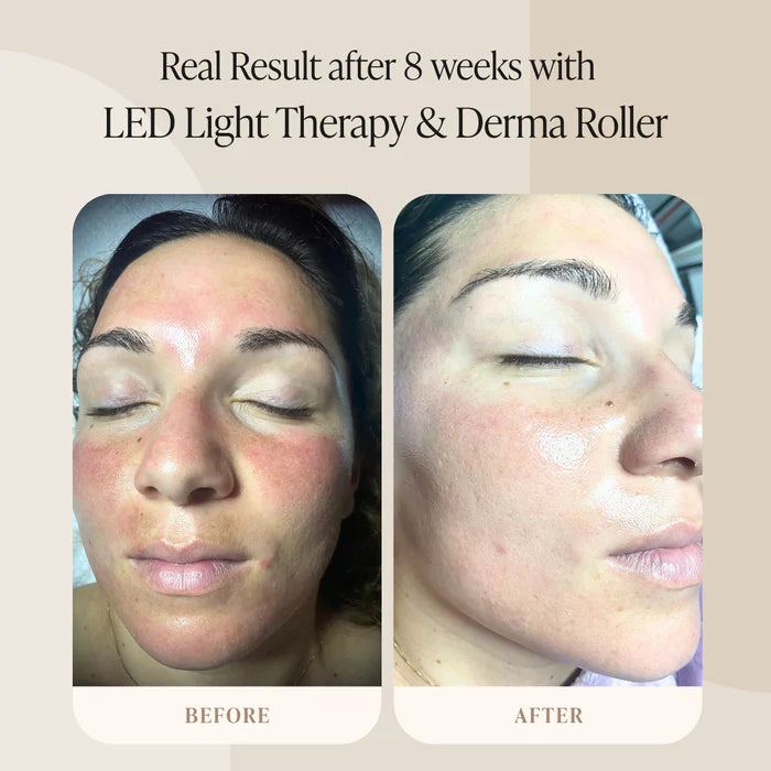 Silkiee DermaFace Pro™