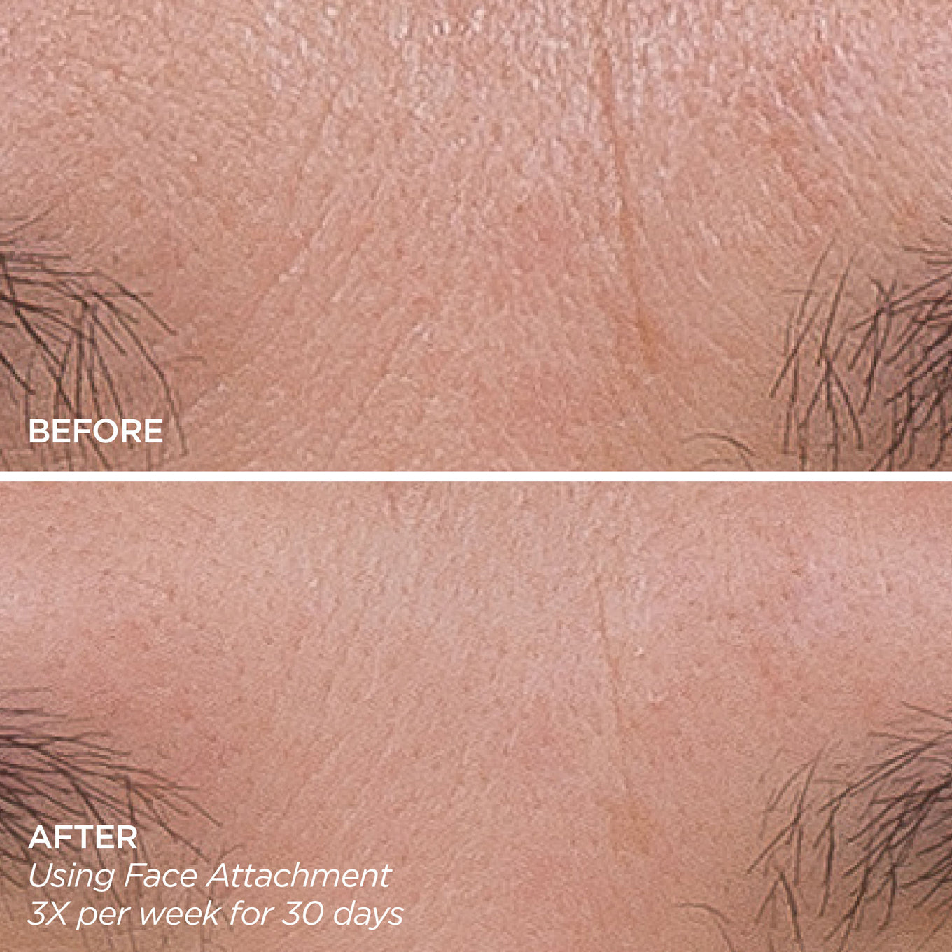 Silkiee DermaFace Pro™