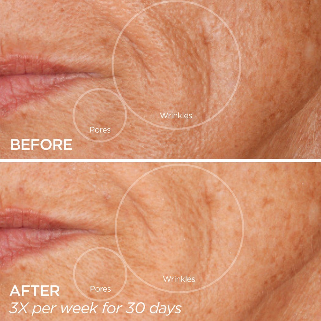 Silkiee DermaFace Pro™